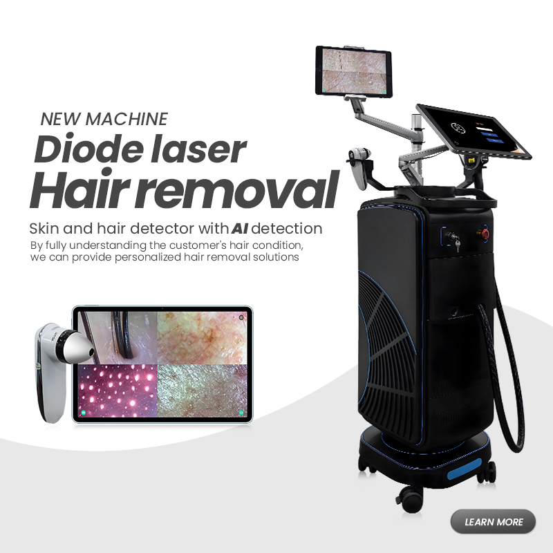 Como funciona uma máquina de depilação a laser?