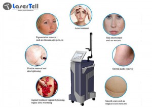 LaserTell Fractional Acne Scars Stretch Marks Removal Co2 Laser Skin Rejuvenation Resurfacing Machine 10.4″ Screen