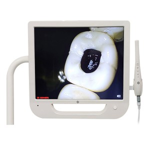 دوربین داخل دهانی سونی کلینیک دندانپزشکی دانشگاه از وضوح فوق العاده بالا استفاده می کند