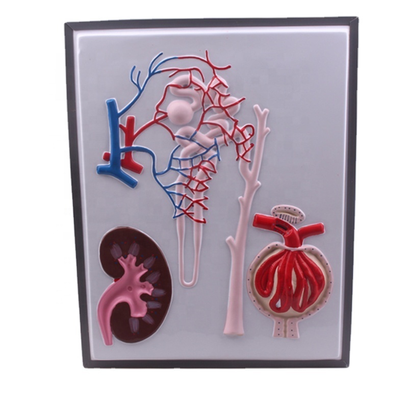 OEM/ODM China Torso Anatomy Model - PVC human kidney nephron and glomerulus model – Lianying