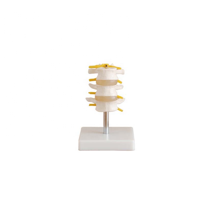 Plastic Normal Lumbar Set Model (3 pcs) / vertebrae