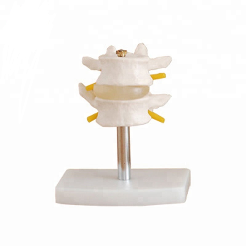 Factory wholesale Head Anatomy Model - Life size medical anatomy 2 parts 3D lumbar Vertebral Spine model – Lianying