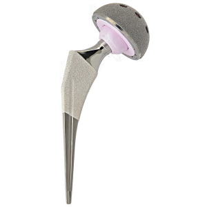 Cementless femoral stem of hips prosthesis