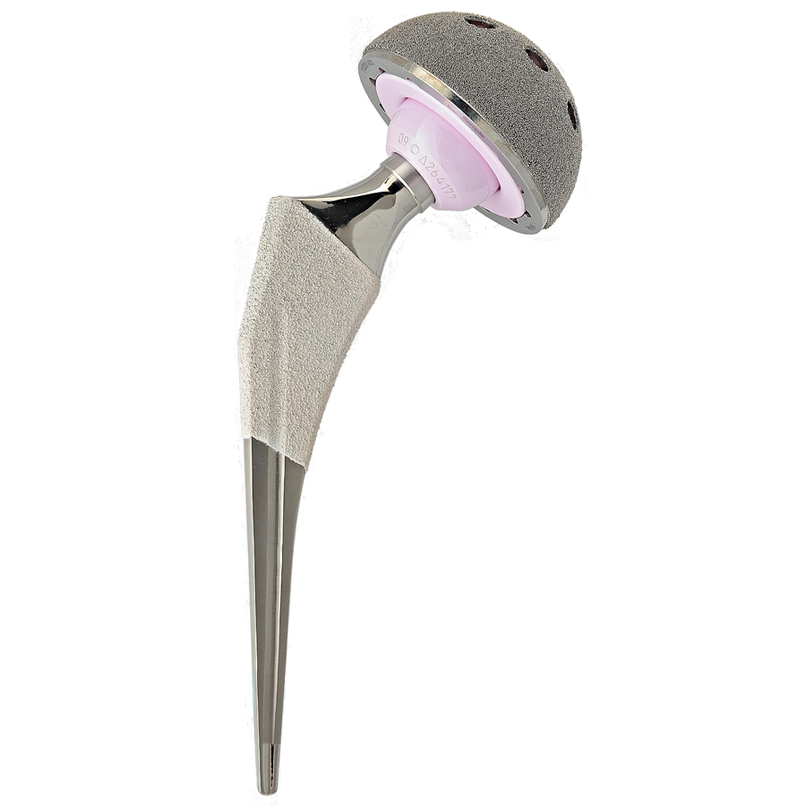 Good Quality Orthopedic Joint Implant - Cementless femoral stem of hips prosthesis – Chenanhui