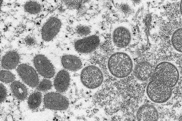 Makro a mikrotest usnadňuje rychlý screening opičích neštovic