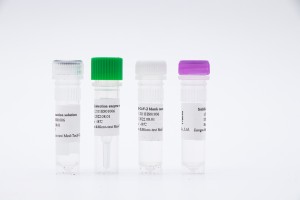 Ikhithi ye-RT-PCR ye-fluorescent yesikhathi sangempela yokuthola i-SARS-CoV-2