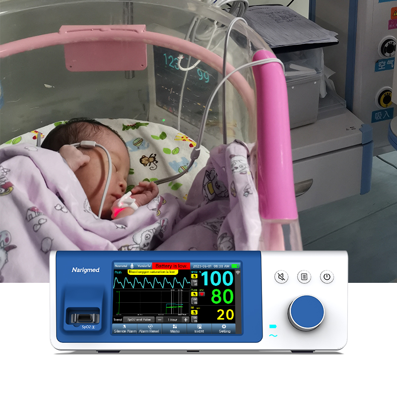 Rëndësia e monitorimit të oksigjenit në gjak për neonatalet