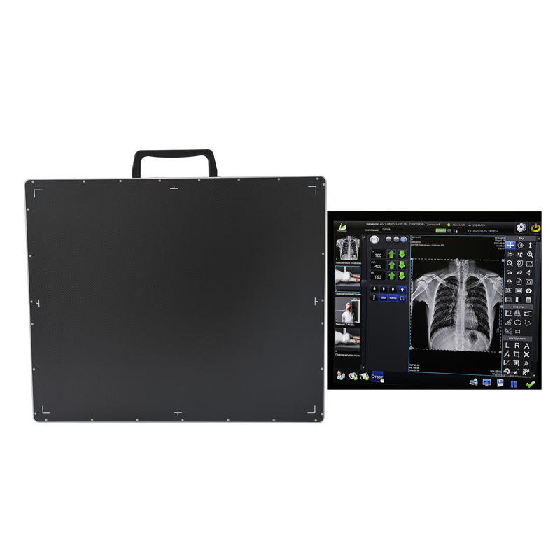 wireless digital x-ray dr flat panel detector Featured Image