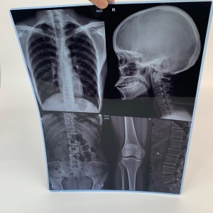 Fim ɗin fim ɗin likita don amfani da injin DR X-ray