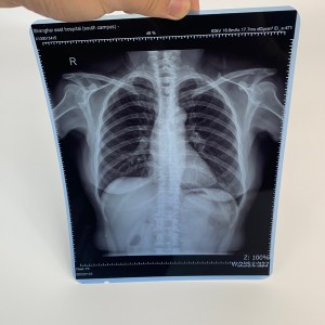 ເຄື່ອງພິມຮູບເງົາທາງການແພດສໍາລັບການນໍາໃຊ້ກັບເຄື່ອງ X-ray DR