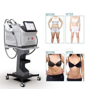 Portable Cryolipolysis Fat Freezing Machine for Removing Belly Arms Anti Cellulite