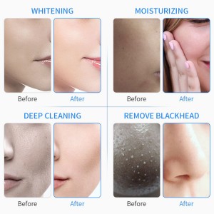 Micro-current Water Jet Beauty youthful microdermabrasion blackhead remover vacuum microdermabrasion machines