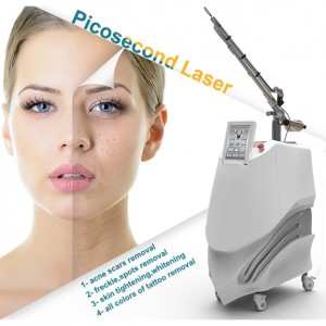 China Factory for China Hot Sale Pico Second Q Switched ND YAG Picosecond Laser Tattoo Removal Machine