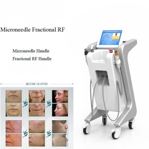 80W fractional rf microneedle wrinkle removal Stretch Marks Treatment