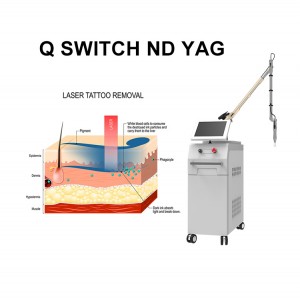 Q switch Nd YAG laser tattoo removal machine 1064nm 532nm