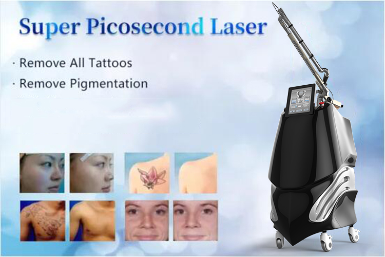 1064nm 532nm 755nm Q-switch Pico Nd Yag Laser for Tattoo Removal