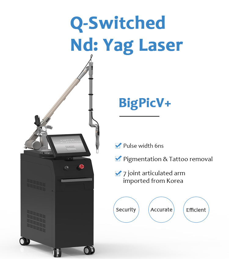 CE approved hot sale vertical q-switched nd yag laser tattoo removal machine for pigment removal