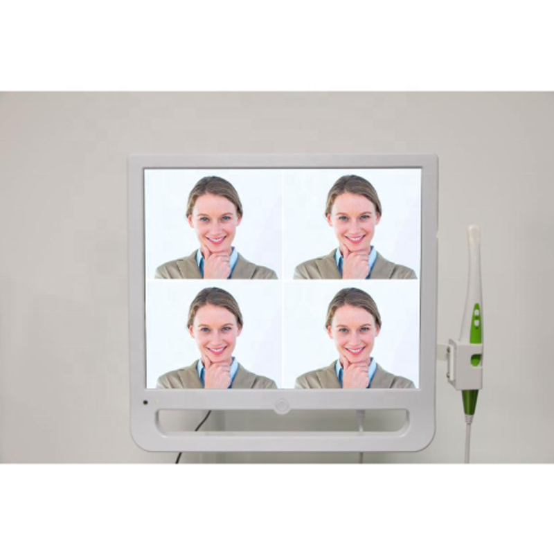 Special Price for Orthodontic Accessories Orthodontic Bite Tubes - 17 inch screen monitor 17 multi-media dental Intra Oral Camera dental digital wireless intraoral system with wifi – Onice detail pictures