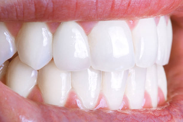 Vai jūs varat tīrīt zobus pārāk smagi?