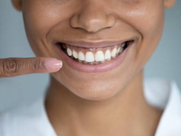 A e dini cilat janë pesë standardet kryesore për shëndetin e dhëmbëve?