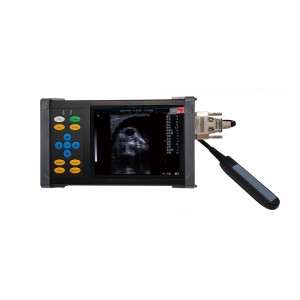 A20  Full Digital Ultrasonic Diagnostic Instrument
