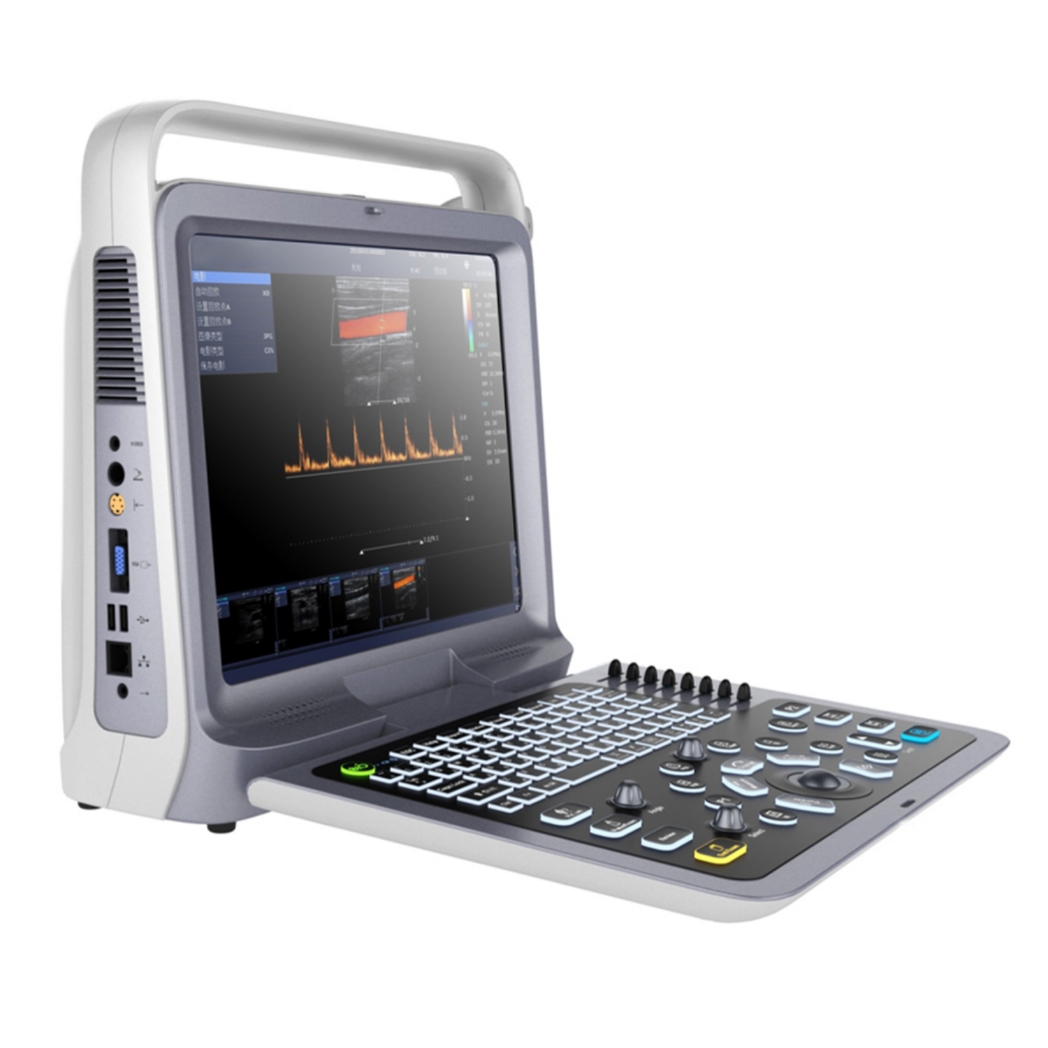 Novo vydaný hot-sell P60 OB&GYN prenosný farebný dopplerovský ultrazvukový prístroj