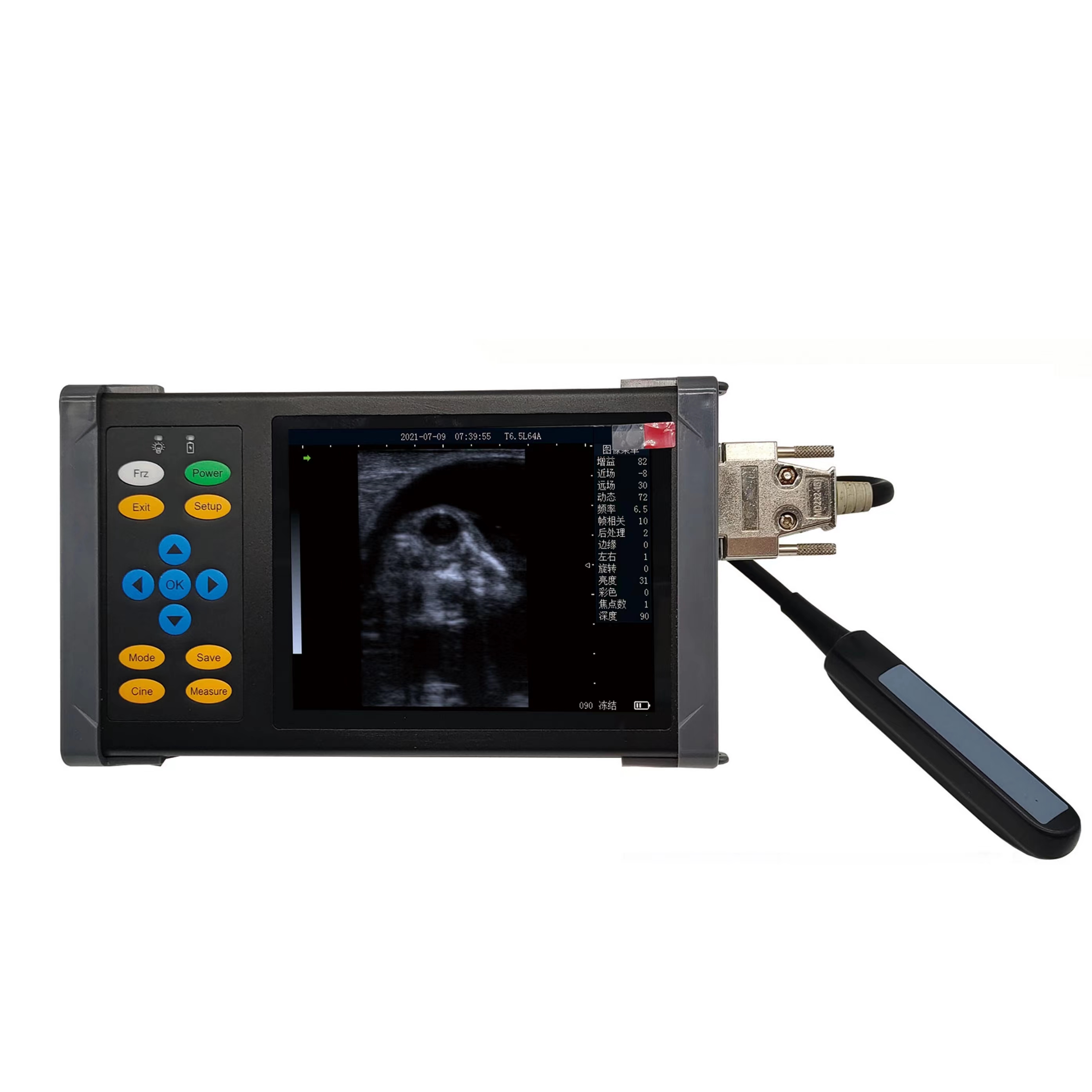 a20-full-digital-ultrasonic-diagnostic-instrument