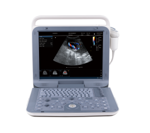 P60 Color Doppler ultrasound diagnostic apparatus