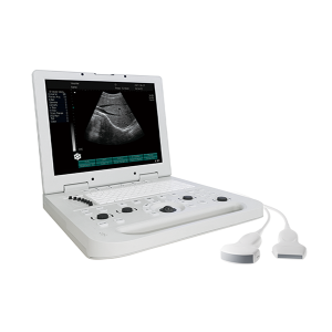 Apparecchio a ultrasuoni per laptop N20 in bianco e nero da 15″ di vendita calda
