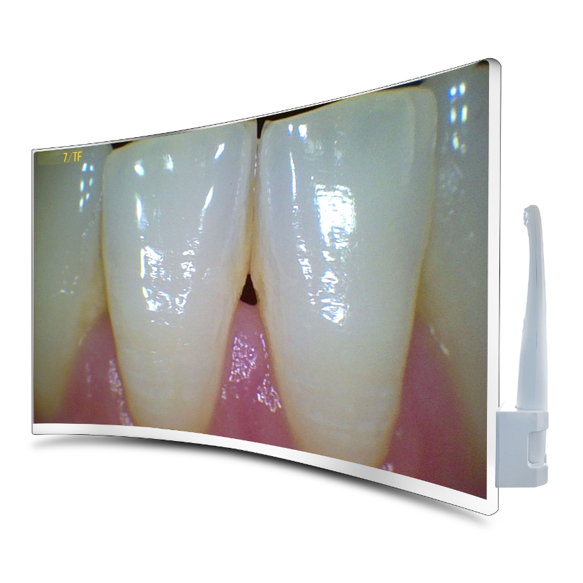 23.8 Inch Curved Screen High Resolution Ultra Thin Intraoral Camera