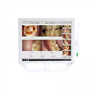 XC-25 Wireless Intraoral Camera With 17 Inch LCD Touch Screen Monitor