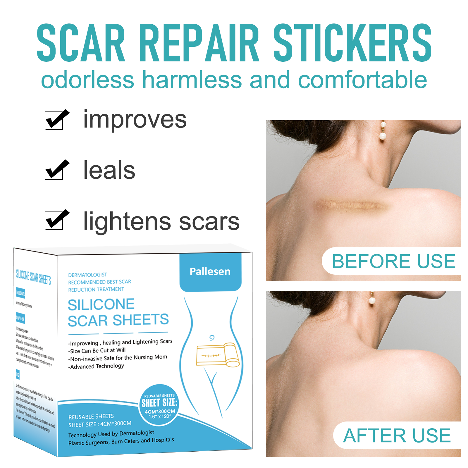 Scars Removal Stickers Self-adhesive Silicone Scar Tape Scar Lightening  Patches