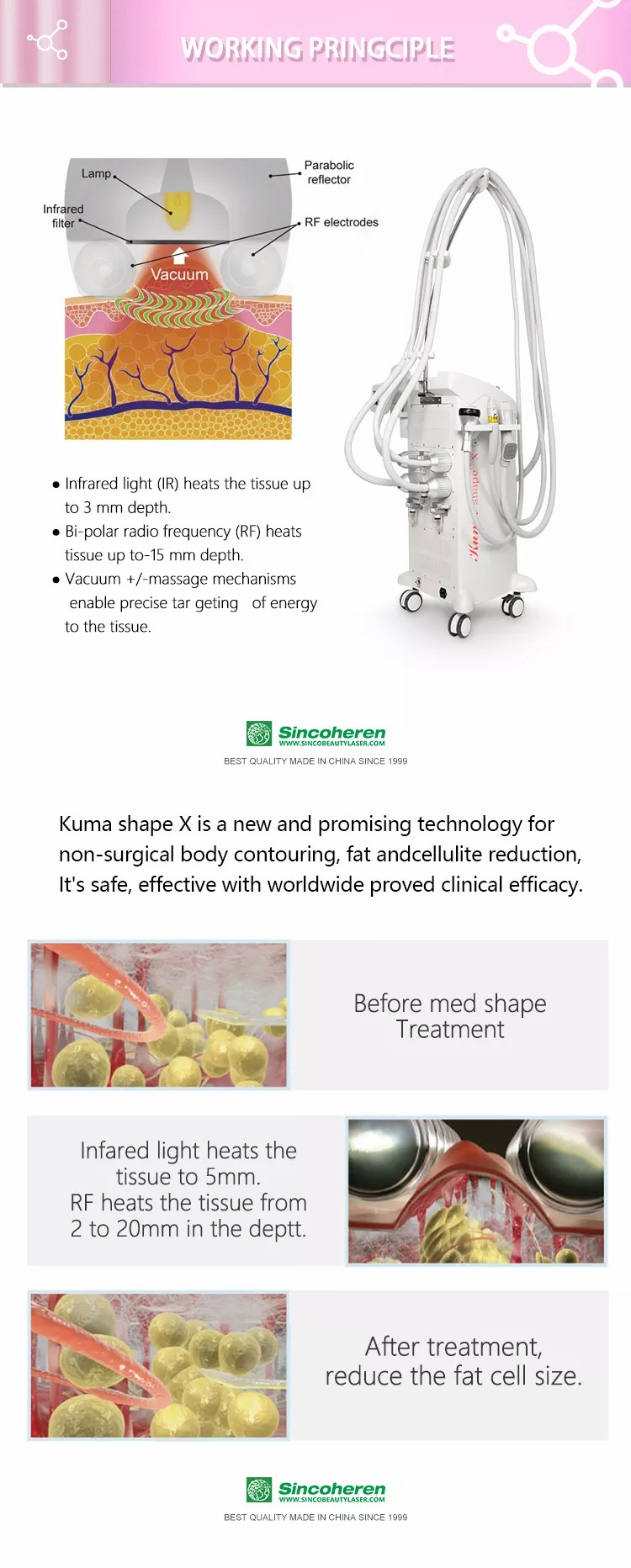 KUMA X Body Slimming Weight Loss RF vakuumski uređaj za izgradnju tijela