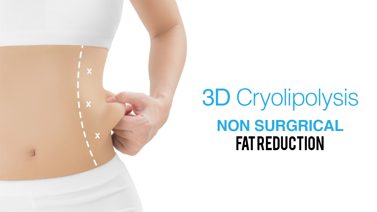 Why Many Beauty Salons Choose Cryolipolysis Machines: A Comprehensive Guide for Buyers