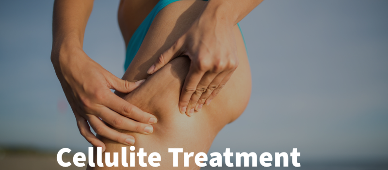 RF Cellulite Treatments & Skin Tightening Treatments