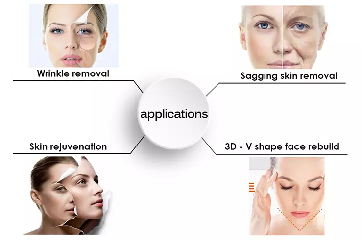 Why HIFU Technology Has Become the New Favorite of Anti-Aging?