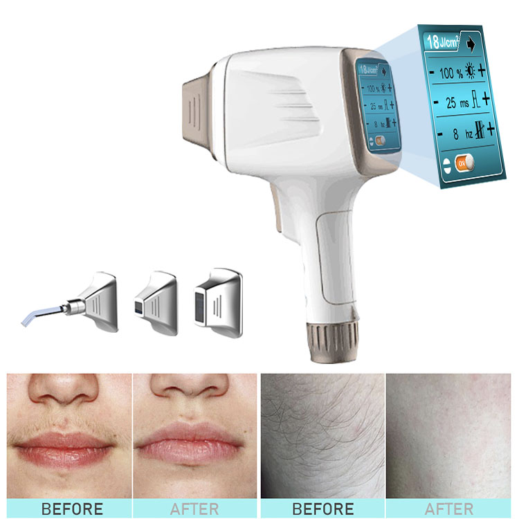 multifunctional professional diode laser hair removal elight skin care beauty salon use