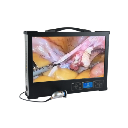 Clear Vision: Unveiling the HD 370 Endoscope Camera System