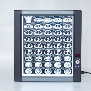 Hospital Quadruple panel Medical film viewer Digital display dental negatoscope