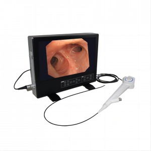 All-in-one high-definition electronic bronchoscope