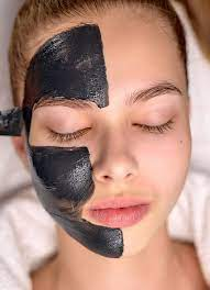 Carbon Peeling is deeply loved by beauty lovers