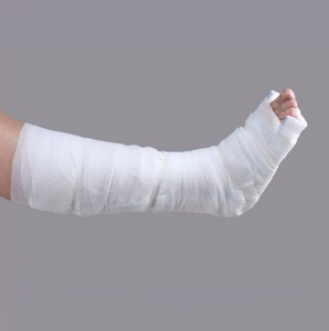 Férula ortopédica médica del brazo del pie de la fibra de vidrio de la emergencia del OEM