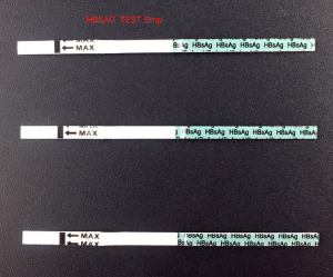 Anticorpo médico do antígeno do vírus da gravidez HCG Troponina Dengue HP HBV Hbsag Glicose sanguínea rápida Anticorpo HCV HIV Malária PF Elisa Kit de teste de urina Tira cassete