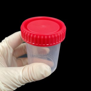 Contenitore per test di raccolta campioni di urina in plastica monouso. Contenitore per urina