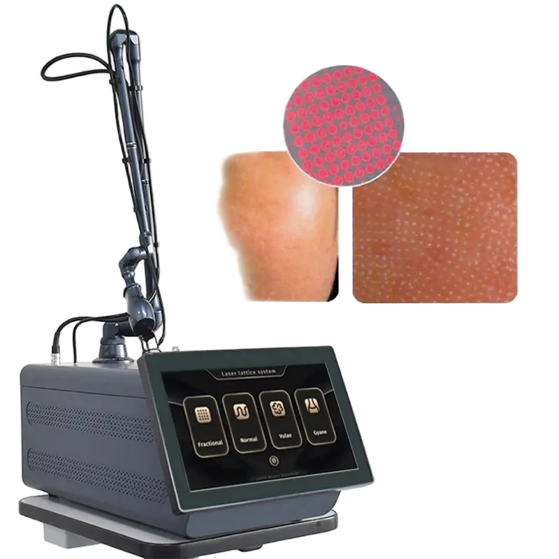 Fractional Co2 laser