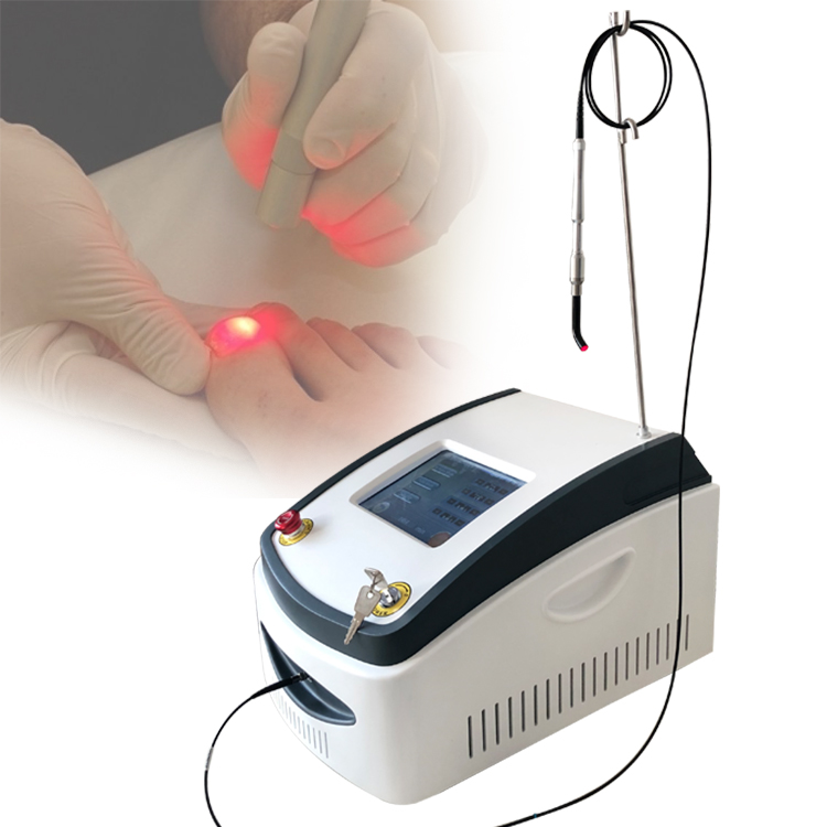 Hot New Products Laser Diod 980 Nm - Factory price laser system for onychomycosis nail fungus treatment medical equipment podiatry nail fungus class IV laser- 980nm Onychomycosis laser – TRI...
