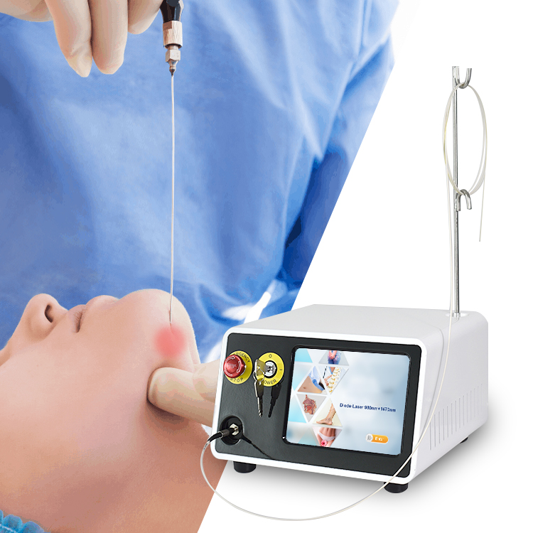 Newly Arrival  physiotherapy laser equipment - ENDOLIFT NON-SURGICAL LASER FACE LIFT – TRIANGEL