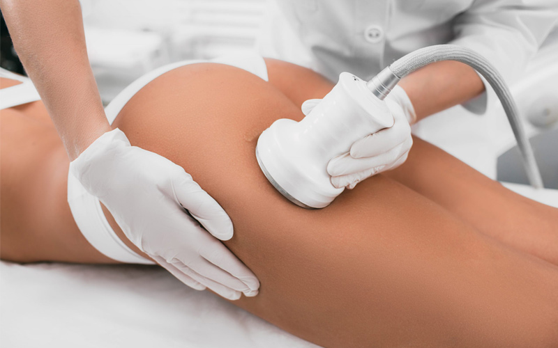 What is Ultrasound Cavitation?