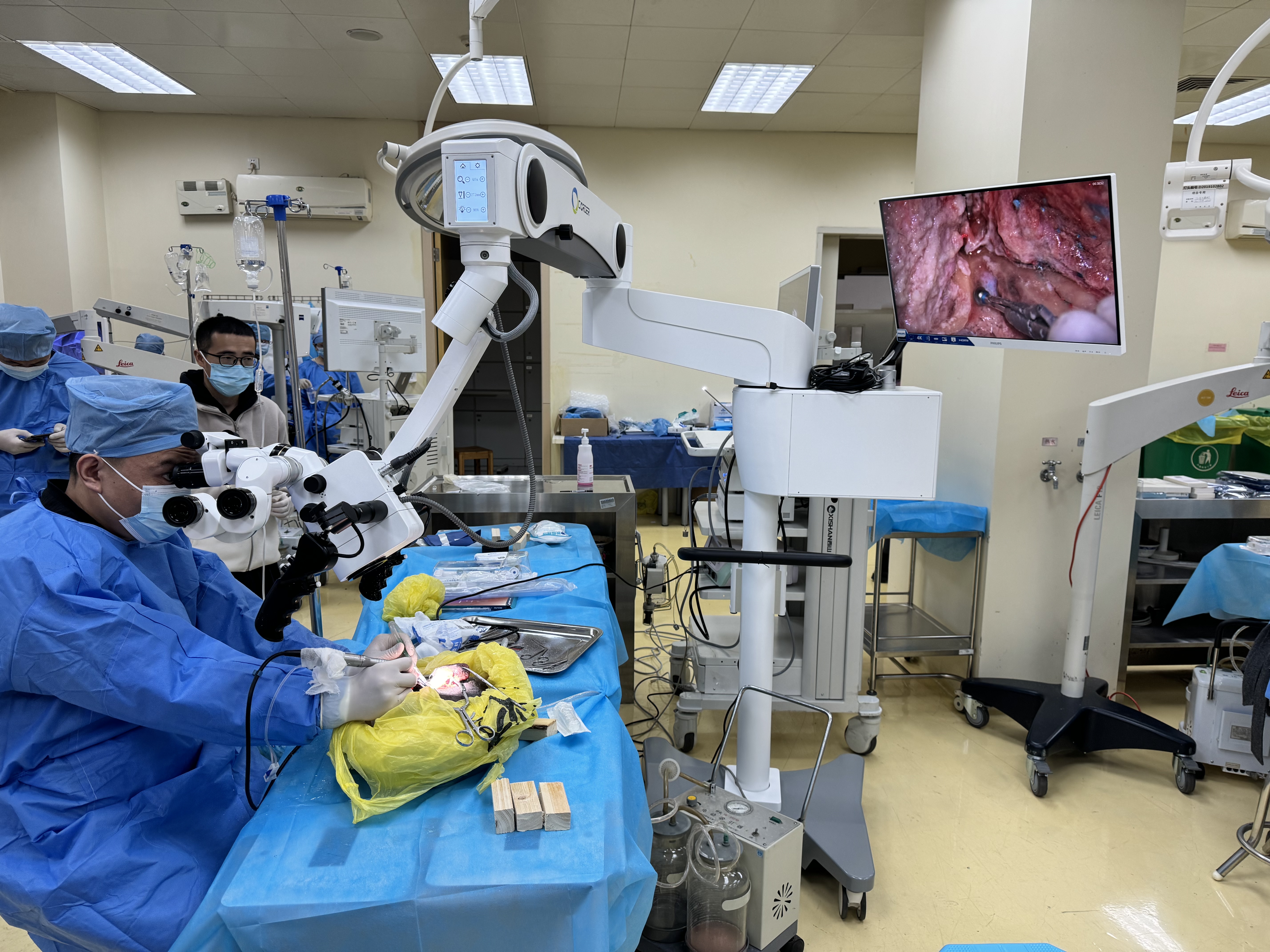 O papel e a importancia dos microscopios cirúrxicos na cirurxía médica