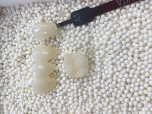 Dental Lab Zirconia Block ST color Preshade 98mm Transparency43% Kusog 1200 Block A1-D4 para sa dental cad cam milling system